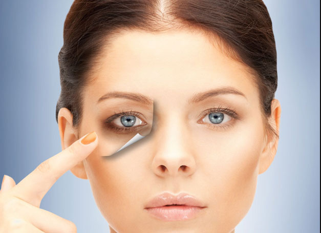 Remove Dark Circles under Eyes Permanently