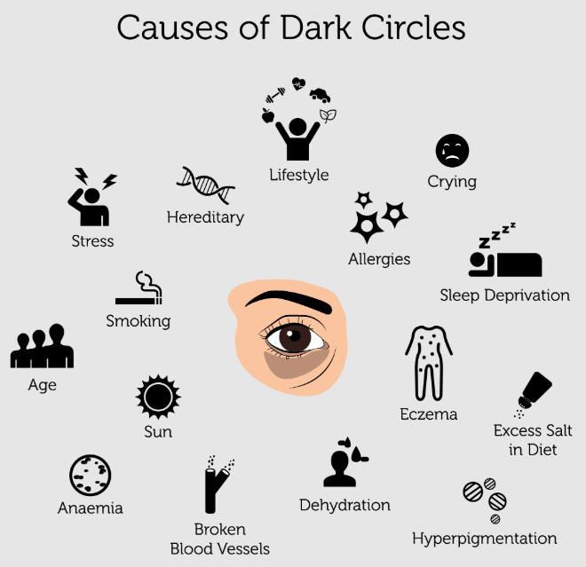 How to Remove Dark Circles under Eyes Permanently