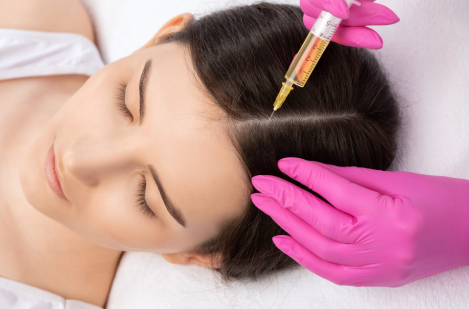 PRP Hair Treatment