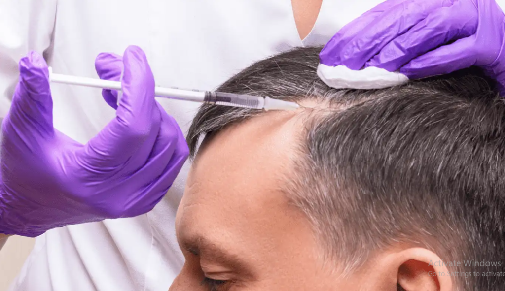 Ultimate PRP Hair Treatment